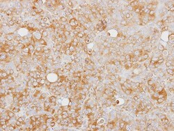 Caspase-1 Antibody, Novus Biologicals 0.1mL; Unlabeled:Antibodies, Polyclonal