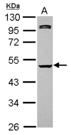 Caspase-1 Antibody, Novus Biologicals 0.1mL; Unlabeled:Antibodies, Polyclonal