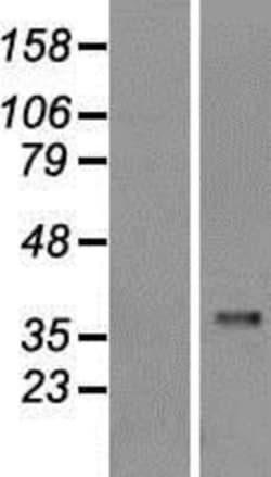 Novus Biologicals&trade;&nbsp;Caspase-1 Overexpression Lysate