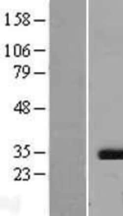 Novus Biologicals&trade;&nbsp;Caspase-3 Overexpression Lysate