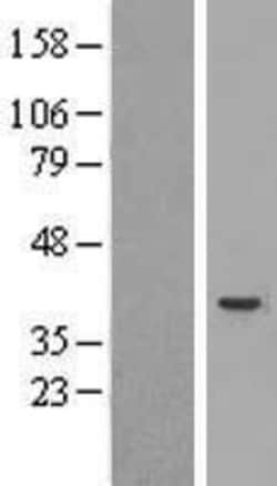 Novus Biologicals&trade;&nbsp;Caspase-4 Overexpression Lysate