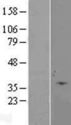Novus Biologicals&trade;&nbsp;Caspase-6 Overexpression Lysate