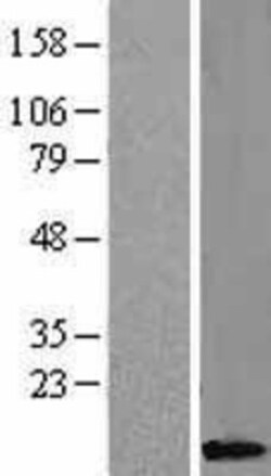 Novus Biologicals&trade;&nbsp;Caspase-8 Overexpression Lysate