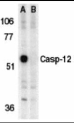 Novus Biologicals&trade;&nbsp;Caspase-12 Antibody Blocking Peptide