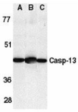 Caspase-13 Antibody, Novus Biologicals 0.1mg; Unlabeled:Antibodies, Polyclonal