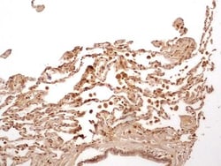 Caspase-1 Antibody (14F468) - BSA Free, Novus Biologicals 0.025mg; Unlabeled:Antibodies,