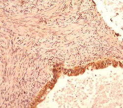 Caspase-1 Antibody (14F468) - BSA Free, Novus Biologicals 0.025mg; Unlabeled:Antibodies,