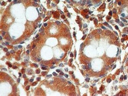 Caspase-3 Antibody (31A1067) - (Pro and Active) - Azide and BSA Free, Novus