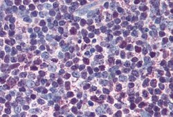 Caspase-3 Antibody (31A1067) - (Pro and Active) - Azide and BSA Free, Novus