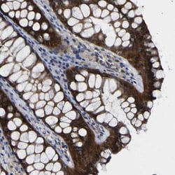 Caspase-6 Antibody, Novus Biologicals:Antibodies:Primary Antibodies