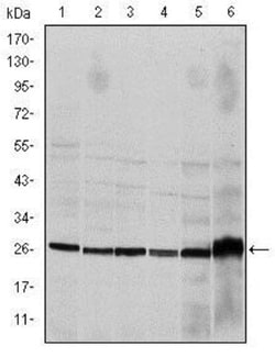 Caspase-8 Antibody (1H11), Novus Biologicals 0.1mL; Unlabeled:Antibodies,
