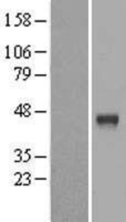 Novus Biologicals&trade;&nbsp;Cathepsin B Overexpression Lysate