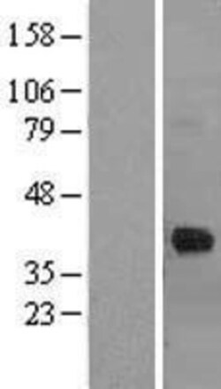 R&D Systems&trade;&nbsp;Cathepsin K Overexpression Lysate