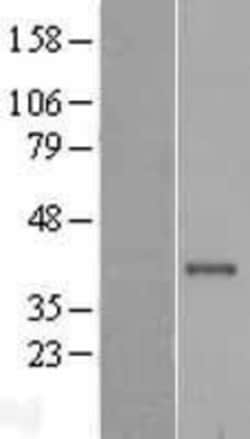Novus Biologicals&trade;&nbsp;Cathepsin S Overexpression Lysate