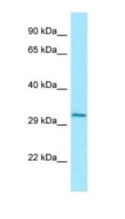 Cathepsin W Antibody, Novus Biologicals 100&mu;L; Unlabeled:Antibodies,