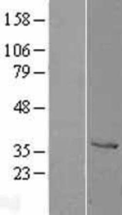 Novus Biologicals&trade;&nbsp;Cathepsin X/Z/P Overexpression Lysate