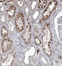Cathepsin A/Lysosomal Carboxypeptidase A Antibody, Novus Biologicals 0.1mL;