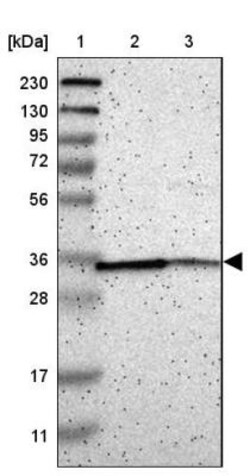 Cathepsin E Antibody, Novus Biologicals 0.1mL; Unlabeled:Antibodies, Polyclonal