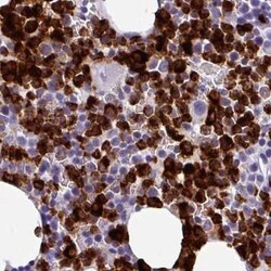 Cathepsin G Antibody, Novus Biologicals:Antibodies:Primary Antibodies