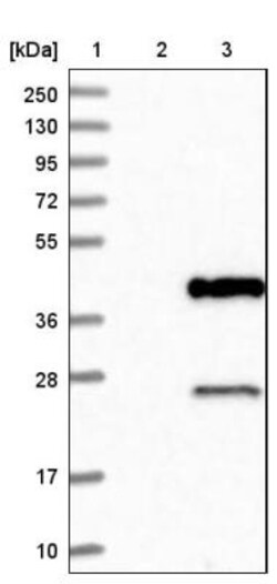 Cathepsin S Antibody, Novus Biologicals 0.1mL; Unlabeled:Antibodies, Polyclonal