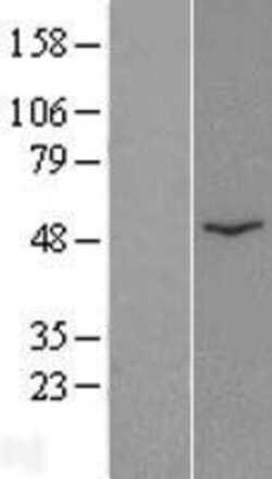 Novus Biologicals&trade;&nbsp;CatSper2 Overexpression Lysate