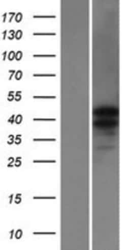 Novus Biologicals&trade;&nbsp;CATSPER3 Overexpression Lysate