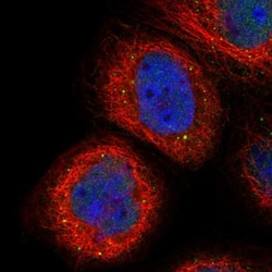 CATSPERB Antibody, Novus Biologicals 25 &mu;L, Unconjugated:Antibodies,