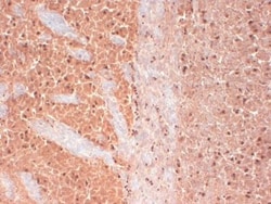 Cav3.2 Antibody (S55/10), Novus Biologicals 0.1mg; Unlabeled:Antibodies,