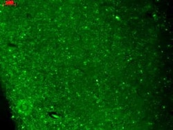 Cav3.2 Antibody (S55/10), Novus Biologicals 0.1mg; Unlabeled:Antibodies,