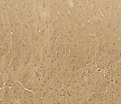 Cav3.2 Antibody - BSA Free, Novus Biologicals:Antibodies:Primary Antibodies