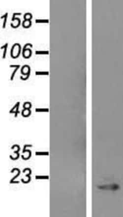 Novus Biologicals&trade;&nbsp;Caveolin-1 Overexpression Lysate
