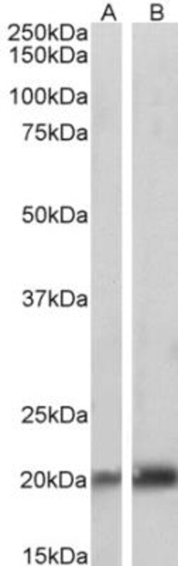 Caveolin-3 Antibody, Novus Biologicals 0.1mg; Unlabeled:Antibodies, Polyclonal