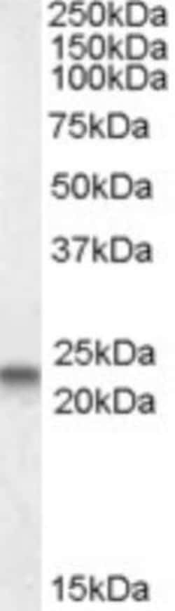 Caveolin-3 Antibody, Novus Biologicals 0.1mg; Unlabeled:Antibodies, Polyclonal