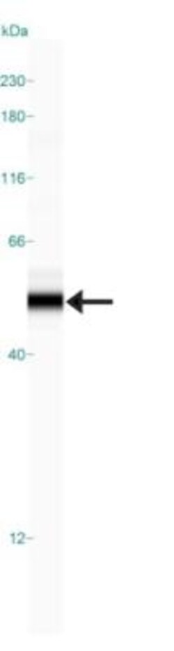 CBARA1 Antibody, Novus Biologicals 0.1mL; Unlabeled:Antibodies, Polyclonal