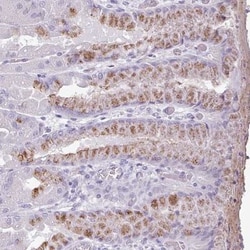 CBE1 Antibody, Novus Biologicals 0.1mL; Unlabeled:Antibodies, Polyclonal