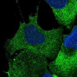 CBFB Antibody, Novus Biologicals 25 &mu;L; Unlabeled:Antibodies, Polyclonal