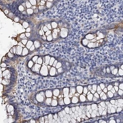 CBFB Antibody, Novus Biologicals 25 &mu;L; Unlabeled:Antibodies, Polyclonal