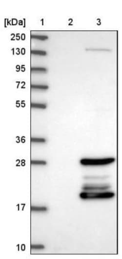 CBFB Antibody, Novus Biologicals 25 &mu;L; Unlabeled:Antibodies, Polyclonal
