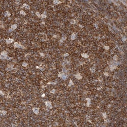 CBL Antibody, Novus Biologicals 0.1mL; Unlabeled:Antibodies, Polyclonal
