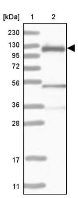 CBL Antibody, Novus Biologicals 0.1mL; Unlabeled:Antibodies, Polyclonal