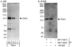 CBLB Antibody, Novus Biologicals 0.1mg; Unlabeled:Antibodies, Polyclonal