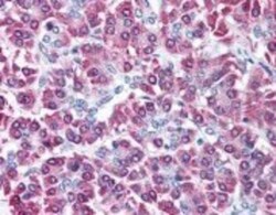 Cbl-c Antibody, Novus Biologicals 0.1mg; Unlabeled:Antibodies, Polyclonal