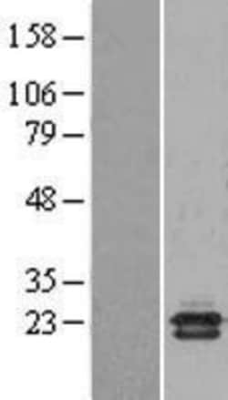 R&D Systems&trade;&nbsp;CBP20 Overexpression Lysate