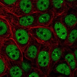 CBP/KAT3A Antibody, Novus Biologicals 0.1mL; Unlabeled:Antibodies, Polyclonal