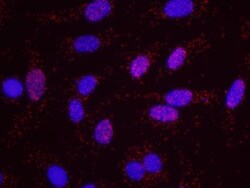 CBP/KAT3A Antibody, Novus Biologicals 0.1mg; Unlabeled:Antibodies, Polyclonal