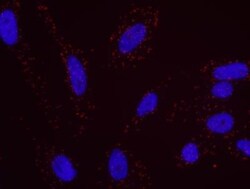 CBP/KAT3A Antibody, Novus Biologicals 0.1mg; Unlabeled:Antibodies, Polyclonal