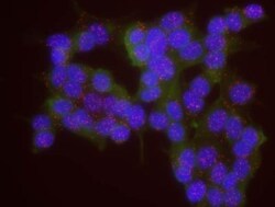 CBP/KAT3A Antibody, Novus Biologicals 0.1mg; Unlabeled:Antibodies, Polyclonal