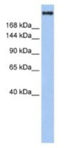 CBP/KAT3A Antibody, Novus Biologicals 100 &mu;L | Buy Online | Novus Biologicals | Fisher Scientific