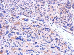 CBR1 Antibody, Novus Biologicals 0.1mg; Unlabeled:Antibodies, Polyclonal