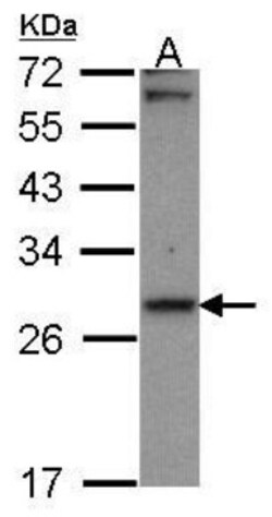 CBR1 Antibody, Novus Biologicals 0.1mg; Unlabeled:Antibodies, Polyclonal